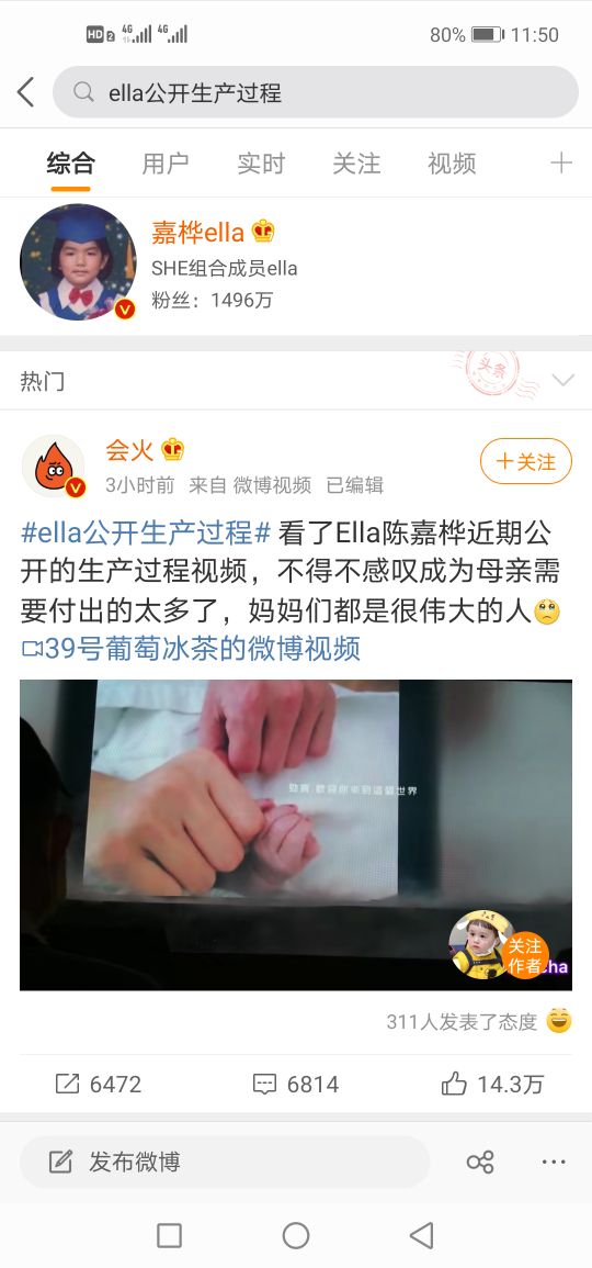 Ella公开生产过程 为儿子顺利出生 劲宝爸爸全程陪产妈妈 娱乐 蛋蛋赞