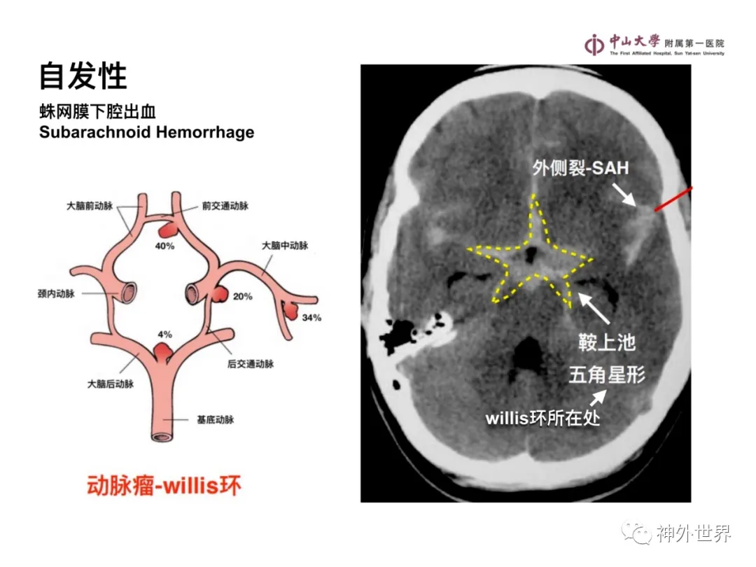 最全影像总结 | 颅内病变 MR、CT 的阅片技巧，太赞了