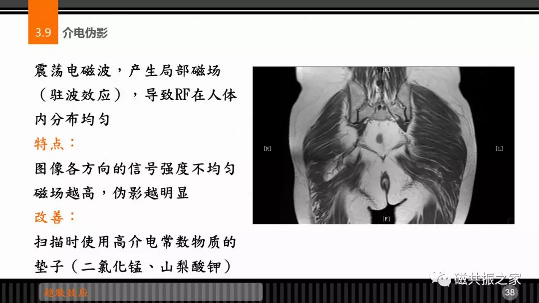 磁共振常见伪影及策略