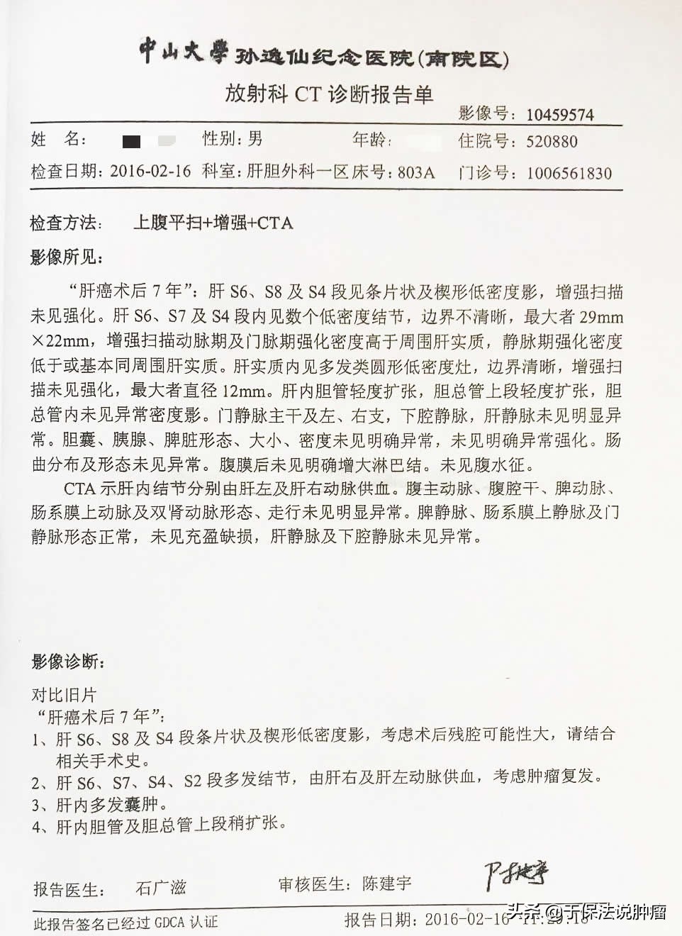 肝癌手术7年复发，经缓释库靶向治疗，至今又已生存超过5年