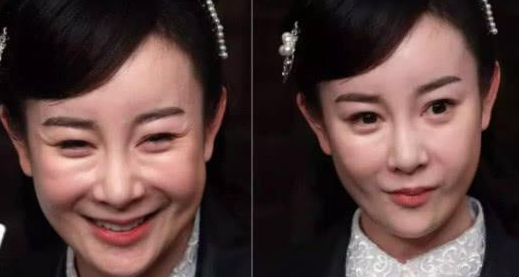 整容毀了多少童年女神，蕭薔王祖賢婁藝瀟，面目全非成毀容