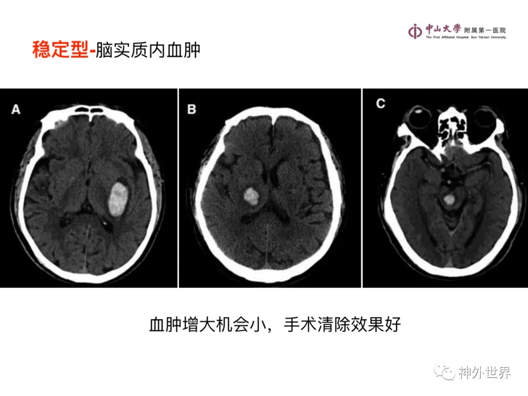 最全影像总结 | 颅内病变 MR、CT 的阅片技巧，太赞了