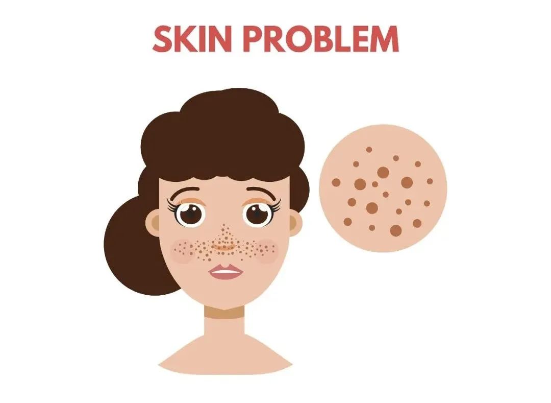 那些皮肤不长斑的人是怎么做到的？