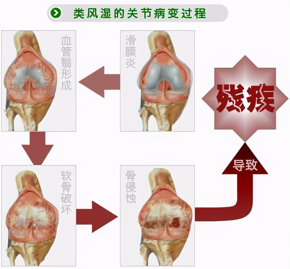 风路同行，感恩有您感恩节┃贵阳中医风湿病医院进社区义诊