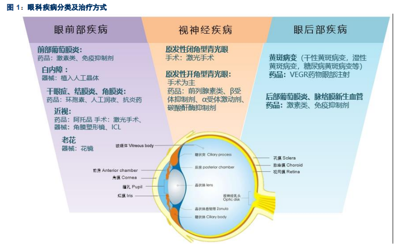 眼科行业研究之人工晶体发展机会专题报告