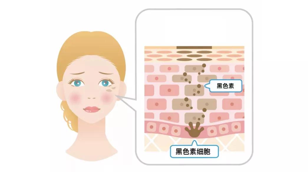 这个秋冬，唯诺雅教你把夏天赠与的黝黑统统都还回去