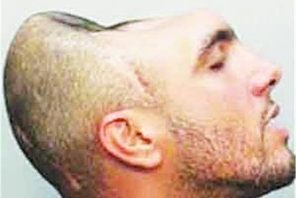 原本只是涉嫌教唆卖淫，却因具有独特生理特征而红遍全球