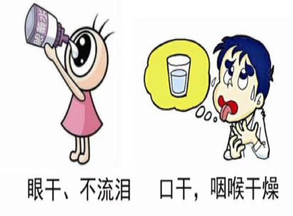 口干喝水没用眼干滴眼药水没用可能是干燥综合征