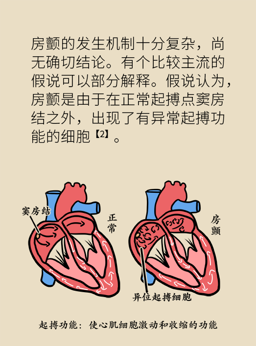 中国房颤日：脑梗风险增高十倍！超过千万人得病还不自知