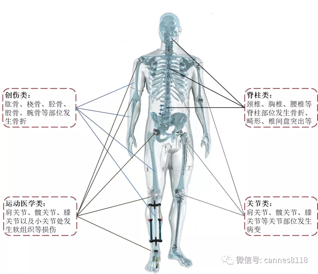 下一个5年40倍机会：骨科带量采购下的风险与机