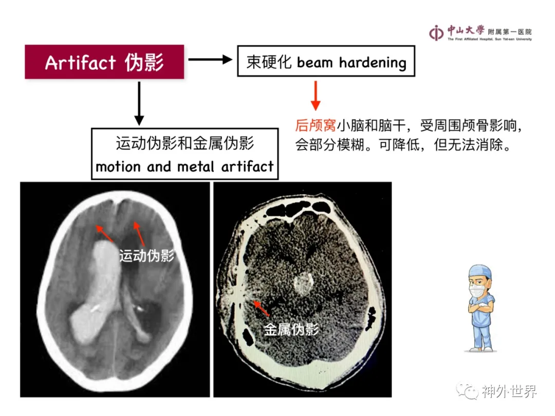 最全影像总结 | 颅内病变 MR、CT 的阅片技巧，太赞了
