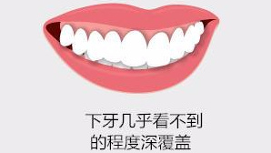 龅牙严重影响面部美观，一笑就露牙龈，牙医告诉你该怎么矫正