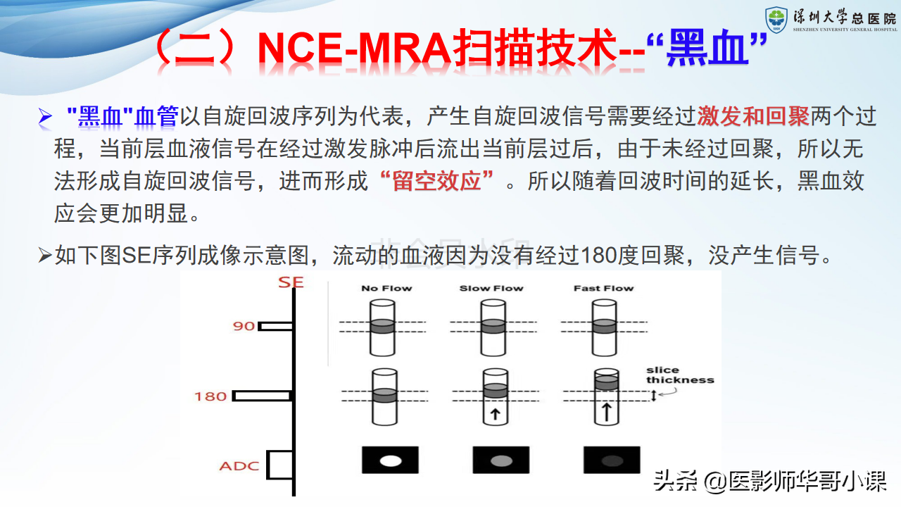 磁共振非增强双下肢血管MRA