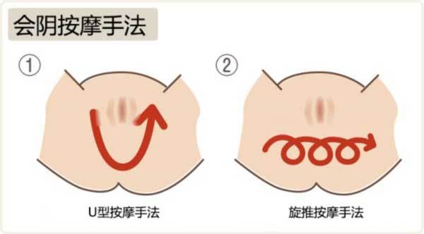 顺产怎么预防侧切