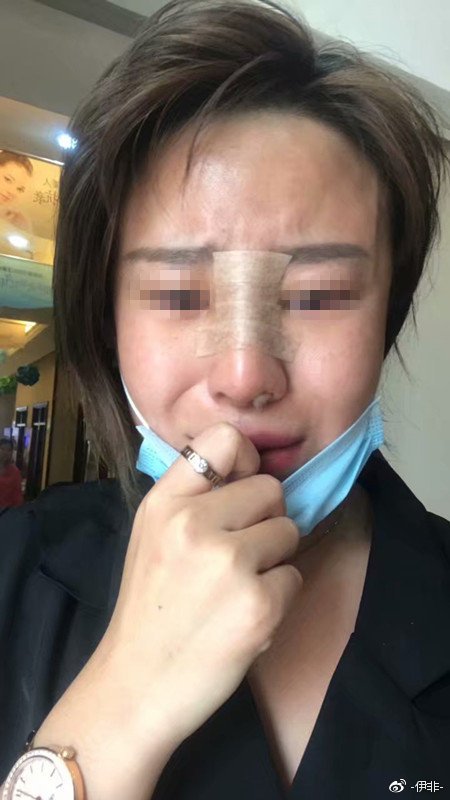 山西太原一女子求助维权，丽都整形是美容还是毁容？