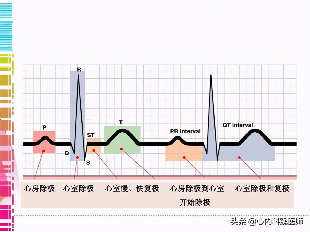 心电图12导联颜色口诀_39健康网_精编内容