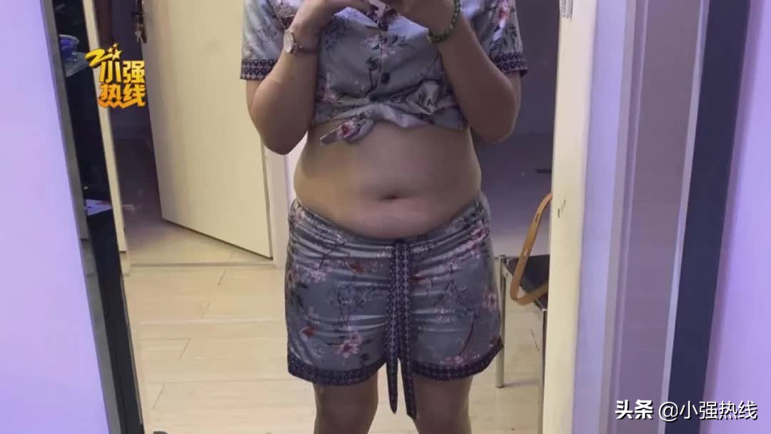 140斤的姑娘抽脂减肥,一次性抽掉4000毫升脂肪