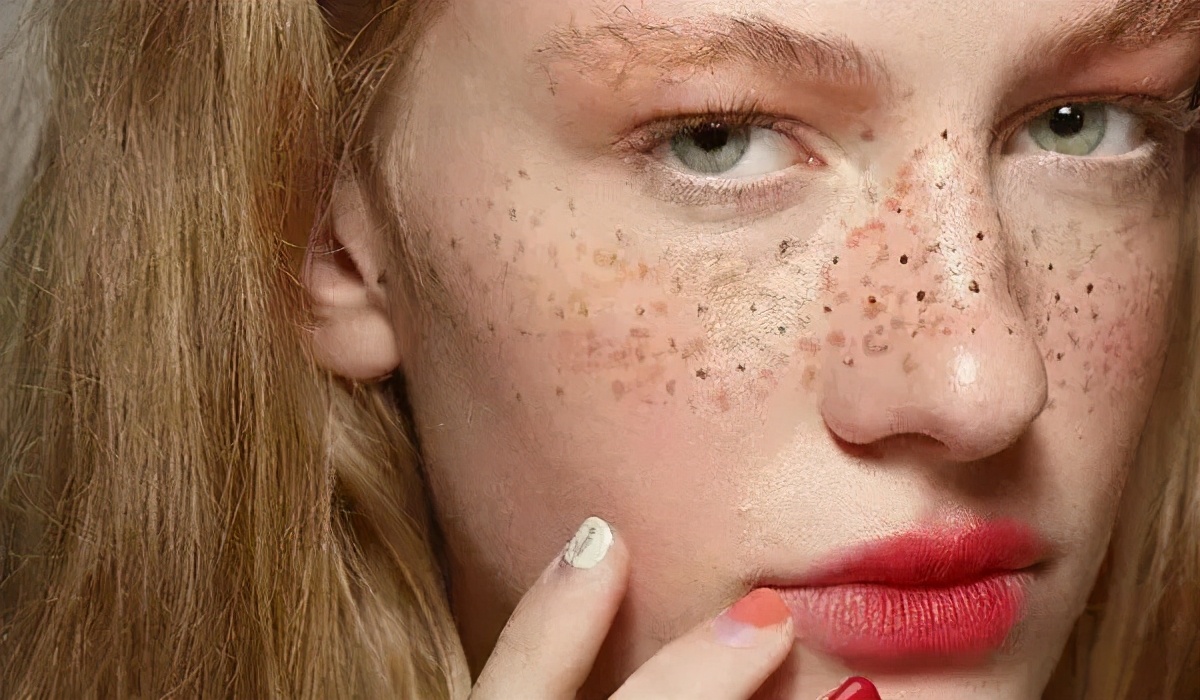 从现在开始，唯诺雅教你不做一“斑”女人