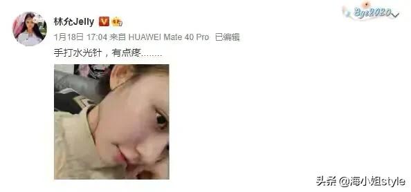被整容坑惨的十大女星，有的变脸有的毁容，为何还是会上瘾？