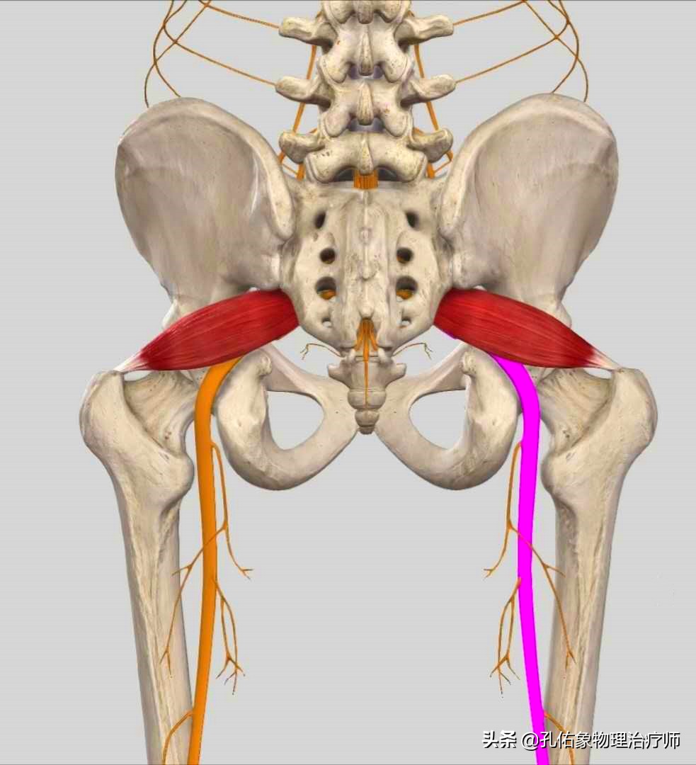 臀部伴下肢疼痛麻木，就是腰椎间盘突出？医生辟谣，教您判断病因