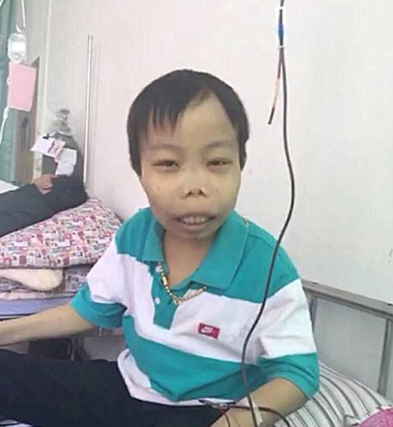 还记得“外星人”陈山吗？封杀3年变化巨大，网