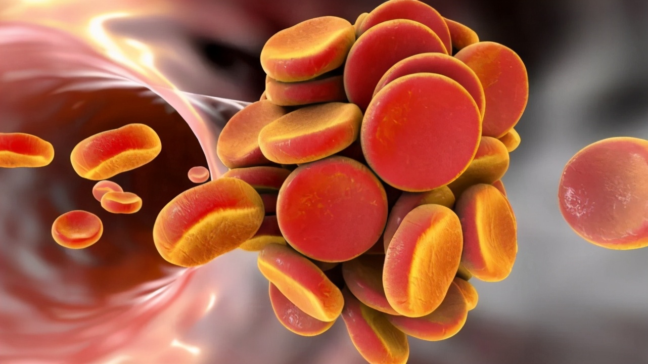 50歲後，不想血液過於黏稠？ 4個習慣要改正，血栓可能會遠離你