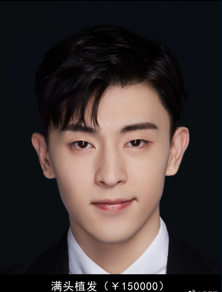 35万！岳云鹏便可整容变成邓伦，邓伦回应坚持梦