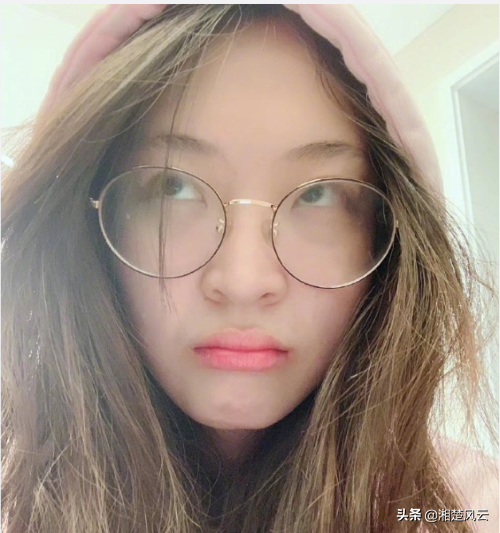 惠若琪一次性拔出四颗智齿，哼了三天！有人拔智齿脸肿得像土拔鼠