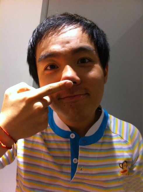 “三毛”长大了！8岁成名，14岁秃顶，34岁变帅哥