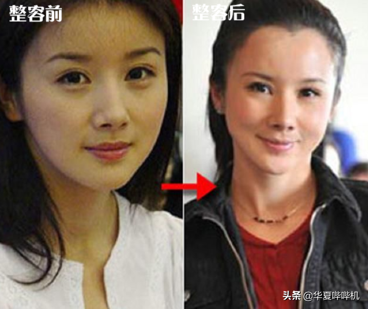 明星大型“翻车”现场，她们是如何整容变毁容