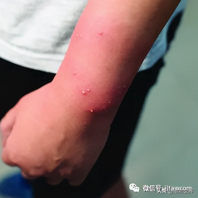 “無敵的”入侵紅火蟻