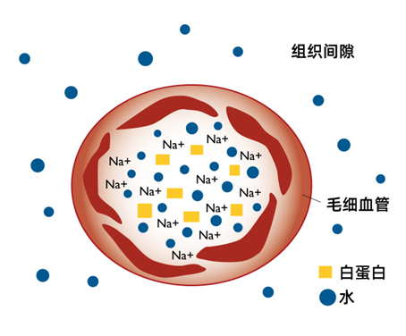 目标导向液体治疗在肝移植围手术期的应用