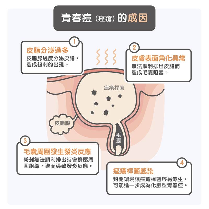 下巴总是反复长痘痘，这是为什么？