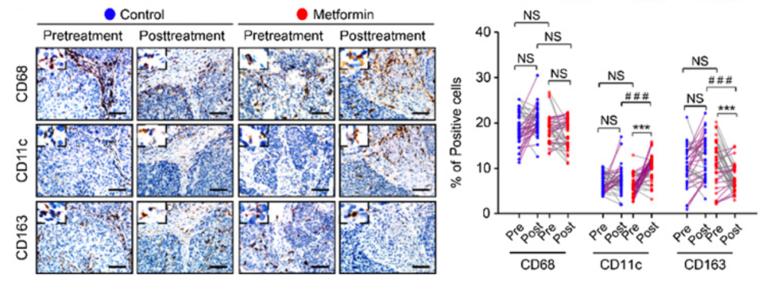 CCR：二甲双胍激活肿瘤免疫微环境！中国科学家发现，低剂量二甲双胍使肿瘤微环境往抗癌方向转变丨临床大发现