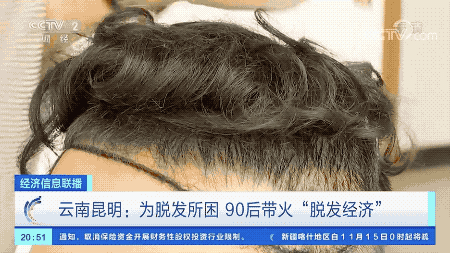 生發(fā)、護(hù)發(fā)、植發(fā)…90后帶火“脫發(fā)經(jīng)濟(jì)”，中國(guó)已有超2.5億人飽受脫發(fā)困擾