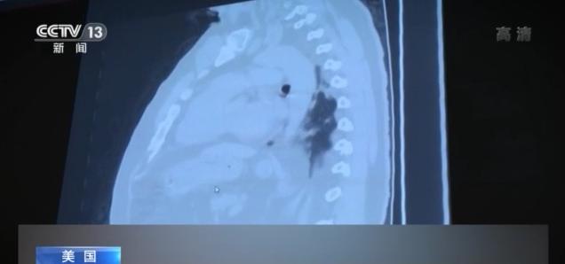 新冠疫情失控、壓力前所未有美國ICU護士：這一年像在地獄裡一樣