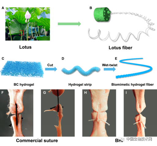 制出|中国科学家制出新型仿生手术缝线受藕断丝连启发