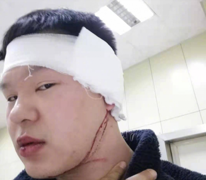 男子提醒邻居降噪反被打伤，拒绝警方删帖要求后被拘，又遭单位解雇