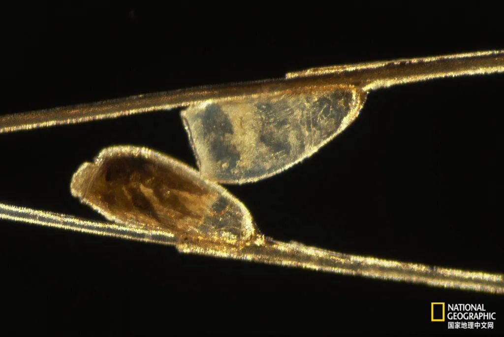 透过显微镜可以看到,头虱的卵附在人的头发上.摄影:darlyne a.
