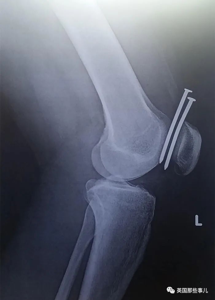 石棺裏藏貓貓，畫下還有另一副畫…X光下的各種物體原來這麽奇妙