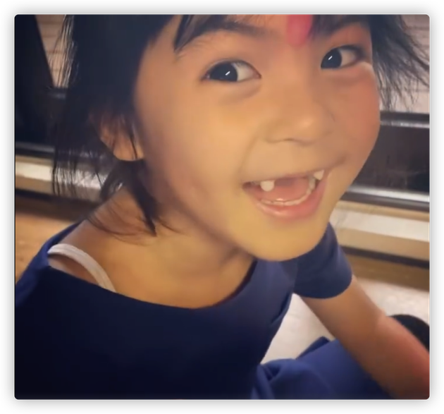 波妞摔斷門牙稱“能當吸血鬼了”，獲媽媽賈靜雯稱讚：樂觀的孩子是天使