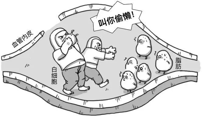 你的血管，就是這樣堵的