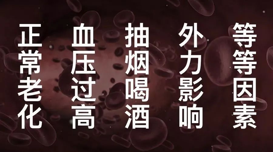 你的血管，就是這樣堵的