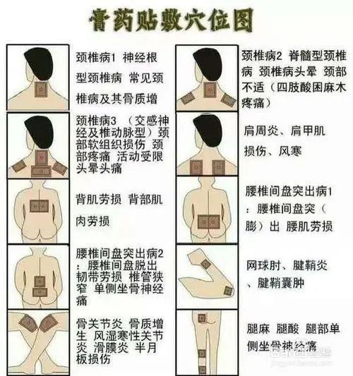 膏药不是你想贴，想贴就能贴