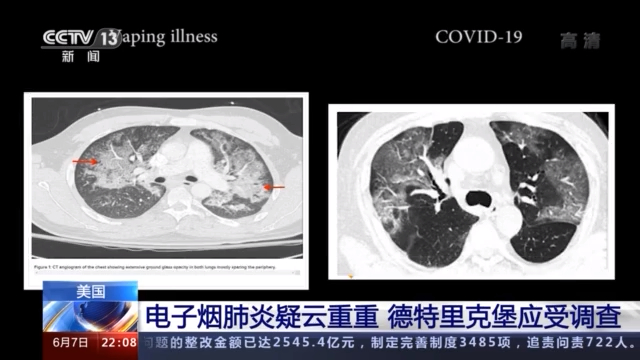 “德特里克堡”！你究竟干了什么？