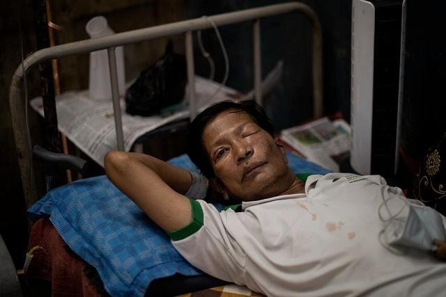 整个人“发霉”而死，可怕疾病蔓延印度