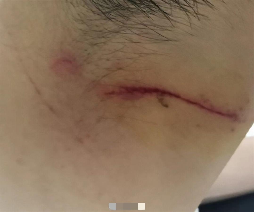 兰州交大研究生遇害案嫌犯被刑拘最新消息兰州交大研究生被害原因真相