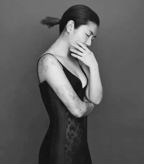 张承中为何娶了毁容的Selina后,又狠心离婚?婚礼的