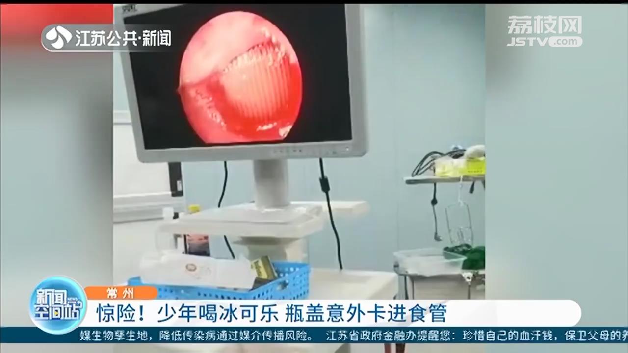 常州少年喝冰可乐，瓶盖意外卡进食管 全麻手术后取出
