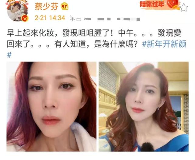 蔡少芬曬懟臉拍鎖骨搶鏡，在線詢問早起嘴腫原因，被侃：張晉親的